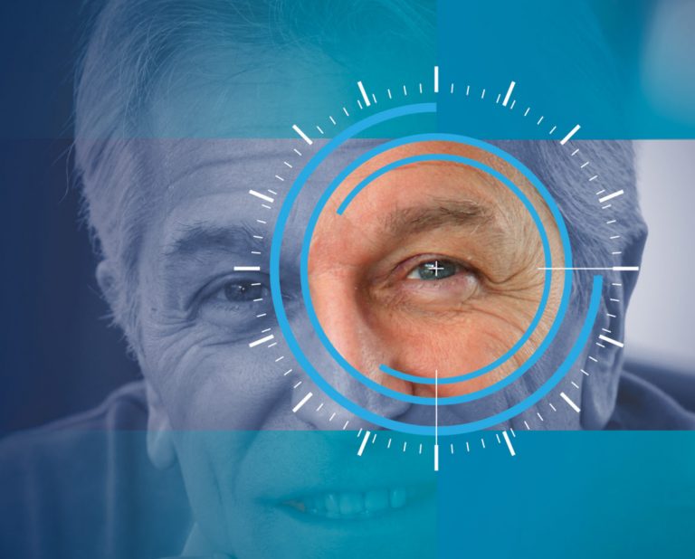 Will I need glasses after cataract surgery?
