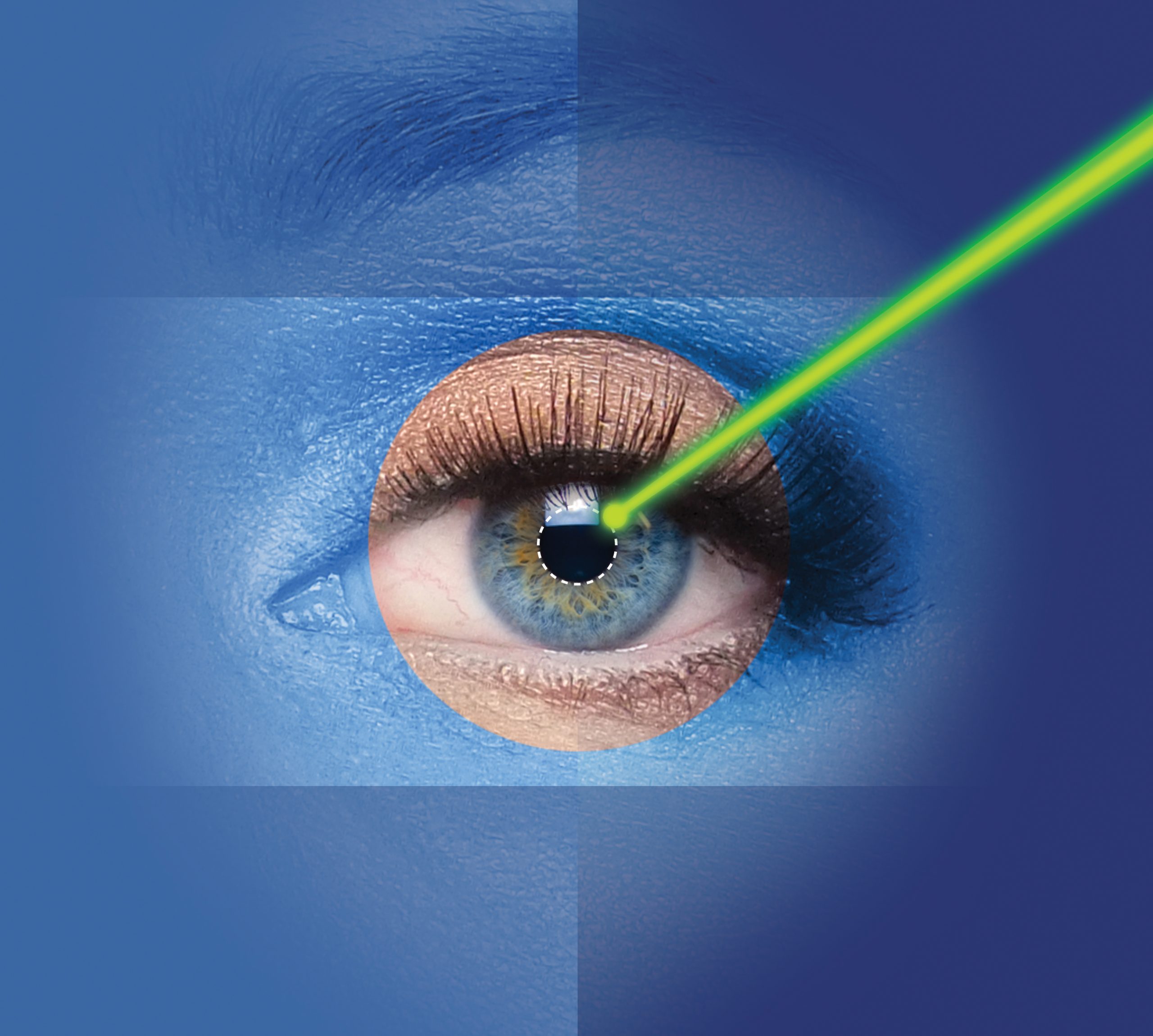 female eye with laser